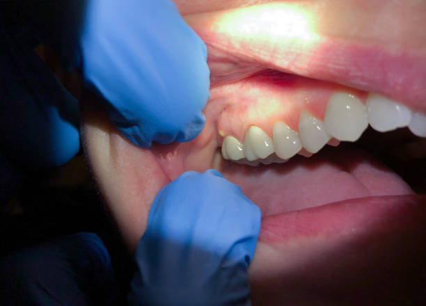 Best Teeth Whitening  in Southmayd, TX